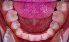 レントゲン被爆や院内感染など医療におけるネガティヴな局面を最小限にするための予防歯科10の約束